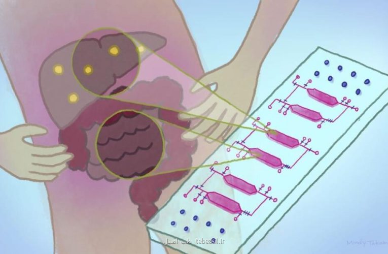 راهکار ژاپنی برای درمان کبد چرب