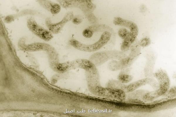 یافته جدید محققان؛ شناسایی یک باکتری که سبب بروز اندومتریوز می شود